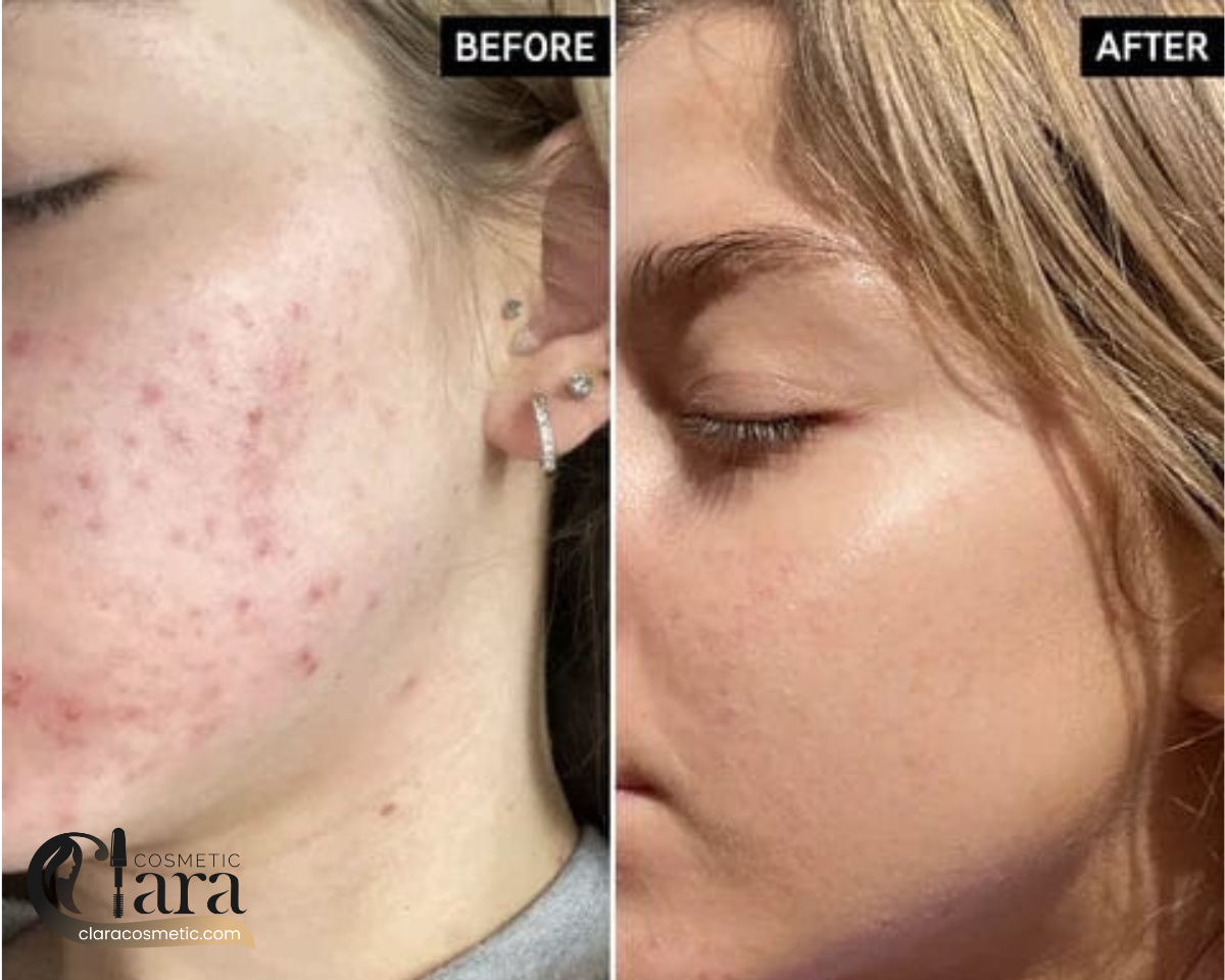 خرید سرم نیاسینامید اوردینری اصل 