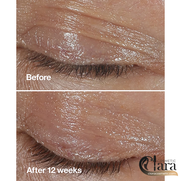 clinique-smart-clinical-repair-wrinkle-correcting-eye-cream-4