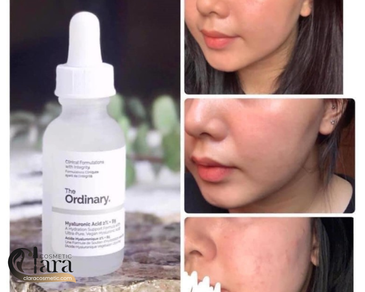 سرم آبرسان هیالورونیک اسید اوردینری