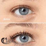 ریمل های ایمپکت کلینیک