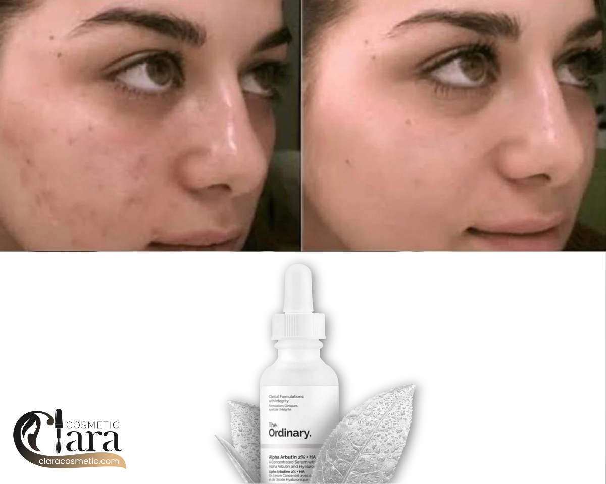 خرید سرم آلفا آربوتین اوردینری