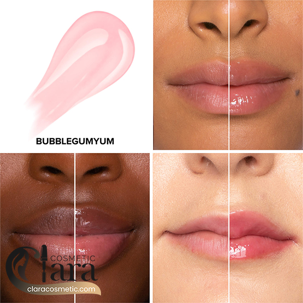 برق لب مایع حجم دهنده اینجکشن توفیسد