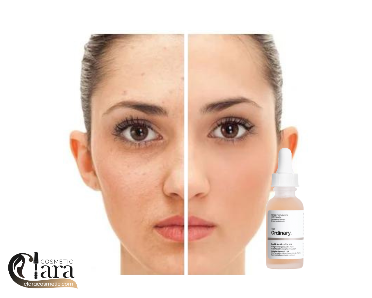 خرید سرم لاکتیک اسید اوردینری اصل