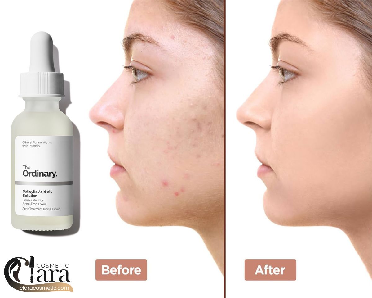 سرم سالسیلیک اسید 2 درصد اوردینری