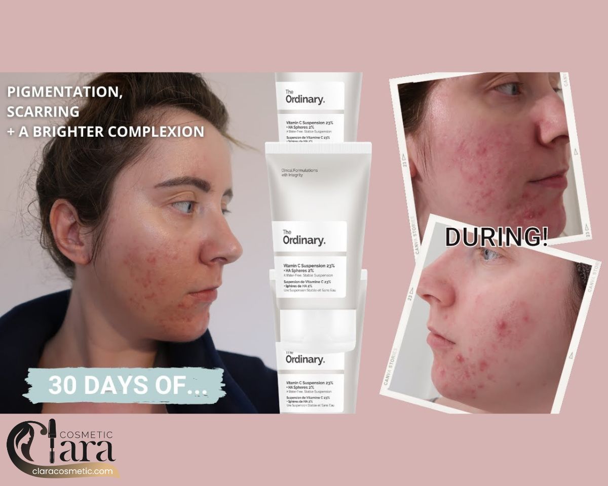 سوسپانسیون ویتامین C حاوی سیلیکون اوردینری