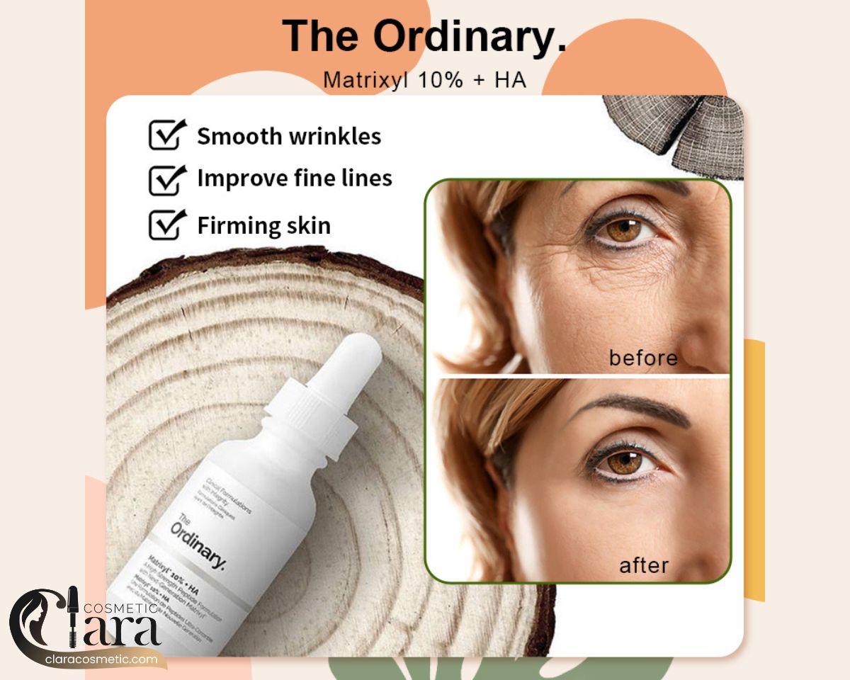 سرم ماتریکسیل 10% + هیالورونیک اسید اوردینری