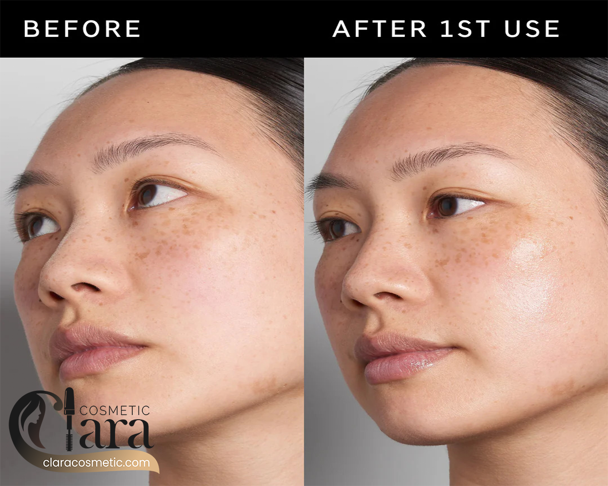 بهترین سرم هیالورونیک اسید چیست