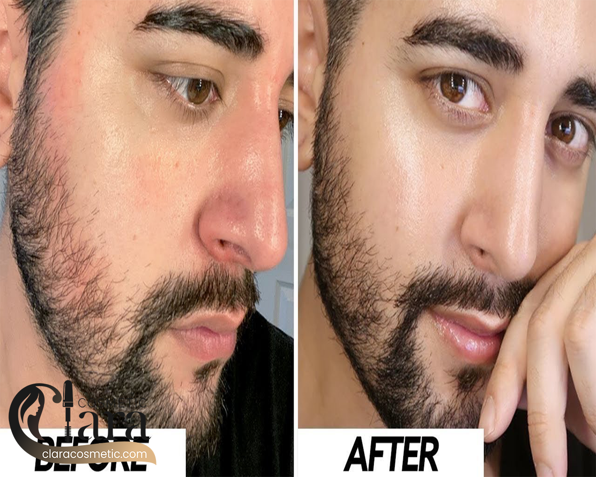 هیالورونیک اسید 2