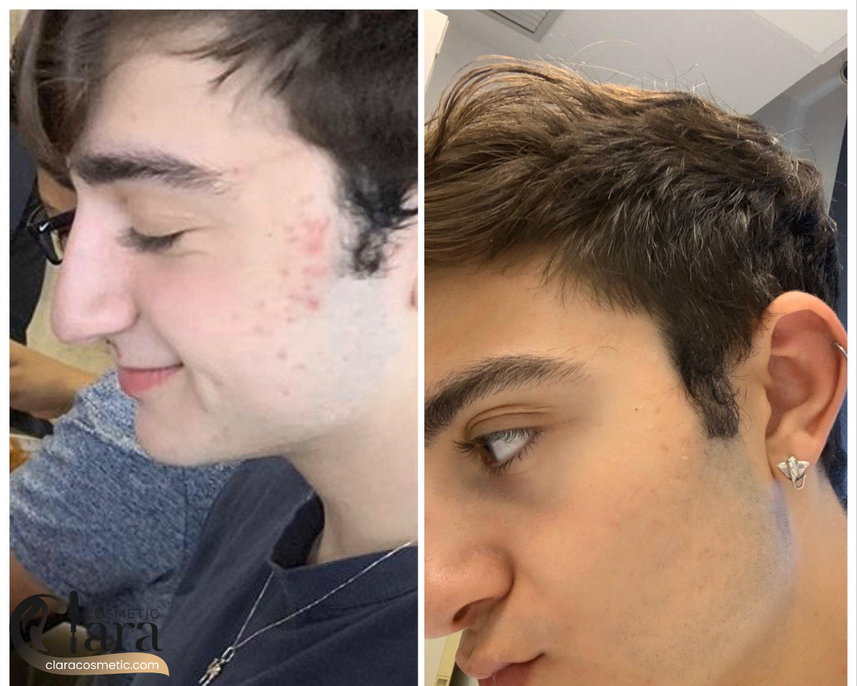 خرید از نمایندگی فروش سرم رتینول اوردینری اورجینال