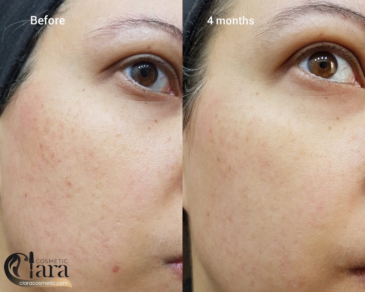 ترکیبات و مواد موثر سرم رتینول اردینری