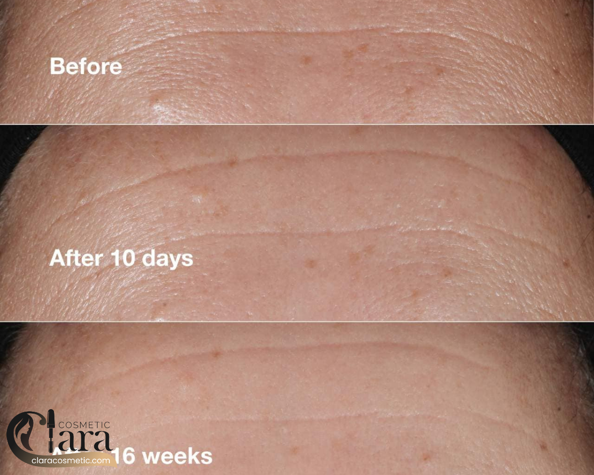 انواع محصولات ضد چروک کلینیک اصل