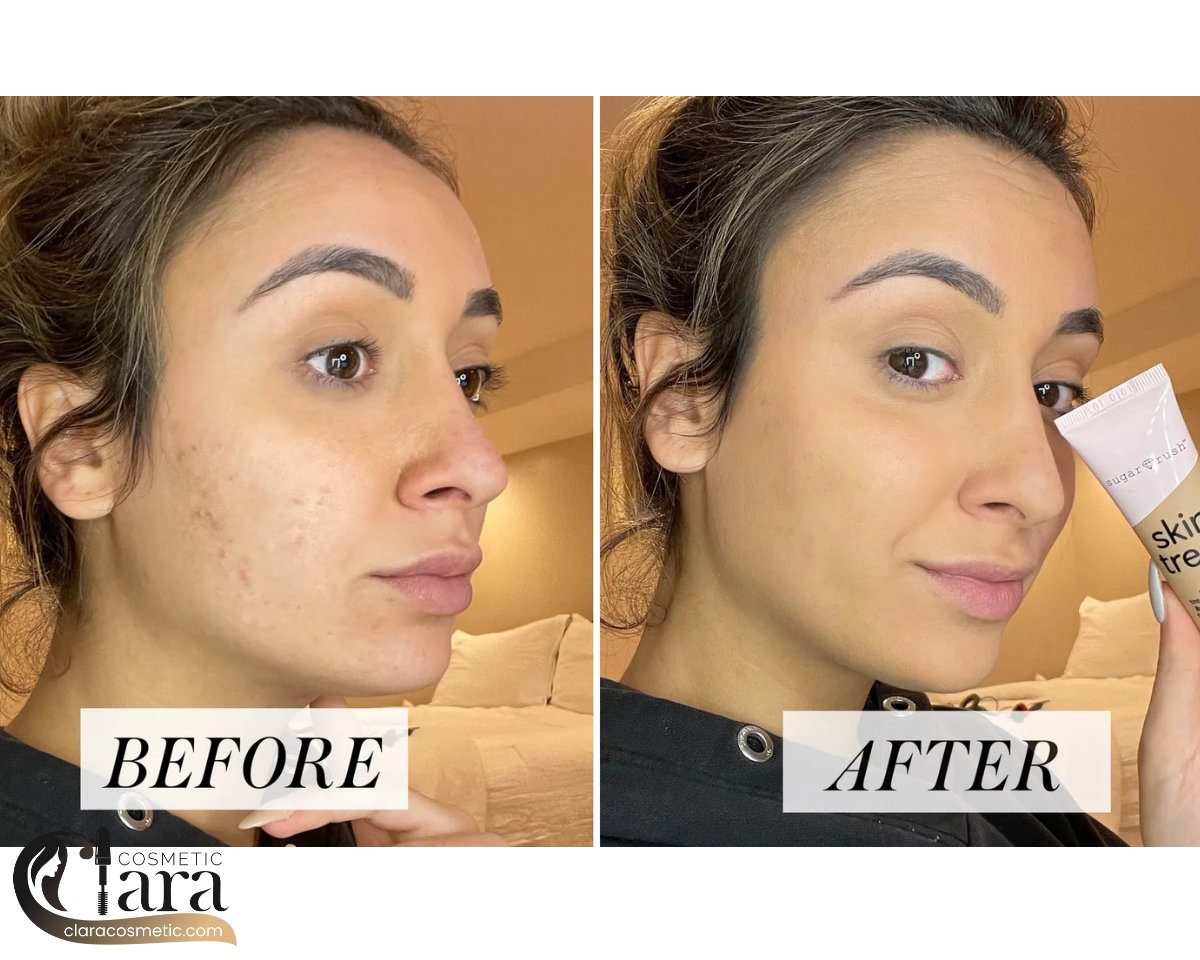 قیمت محصولات تارت در نمایندگی فروش برند تارت