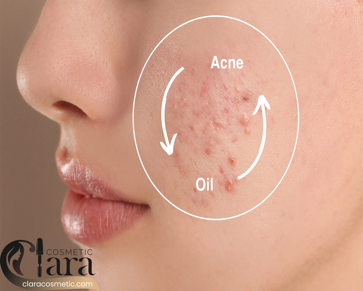 سرم ضد جوش اوردینری