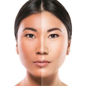 شناخت فرق هیالورونیک اسید و نیاسینامید