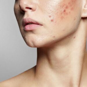 بررسی عوارض روتین پوستی اشتباه