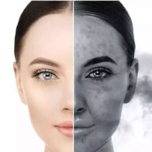 بررسی عوارض روتین پوستی نادرست