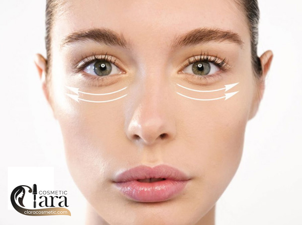 سرم دور چشم ویتامین سی کیلز