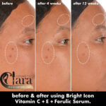 سرم ویتامین C + E + فرولیک الف مدل Bright Icon